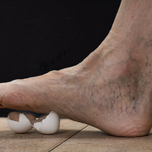 Walking on Egg Shells.jpg